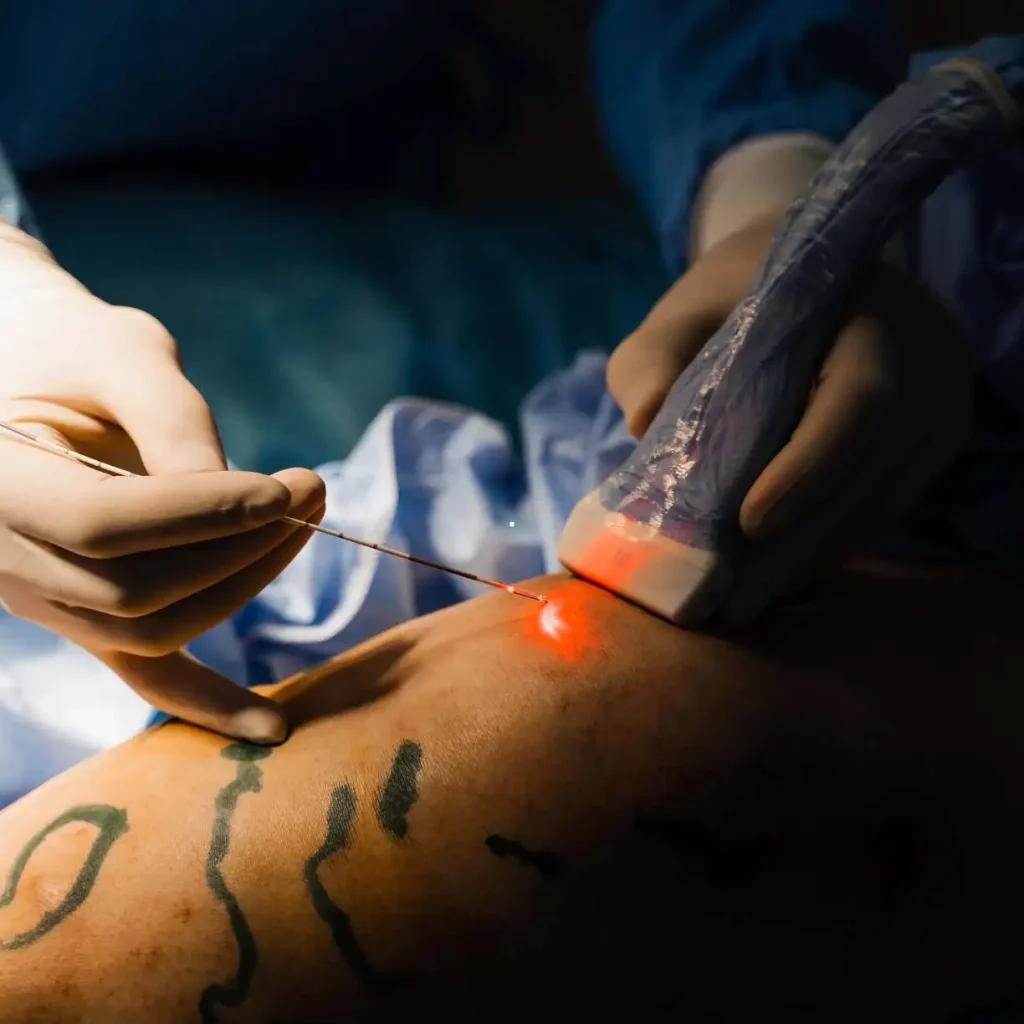 Cirurgião vascular realizando procedimento minimamente invasivo com alta tecnologia em Marília.