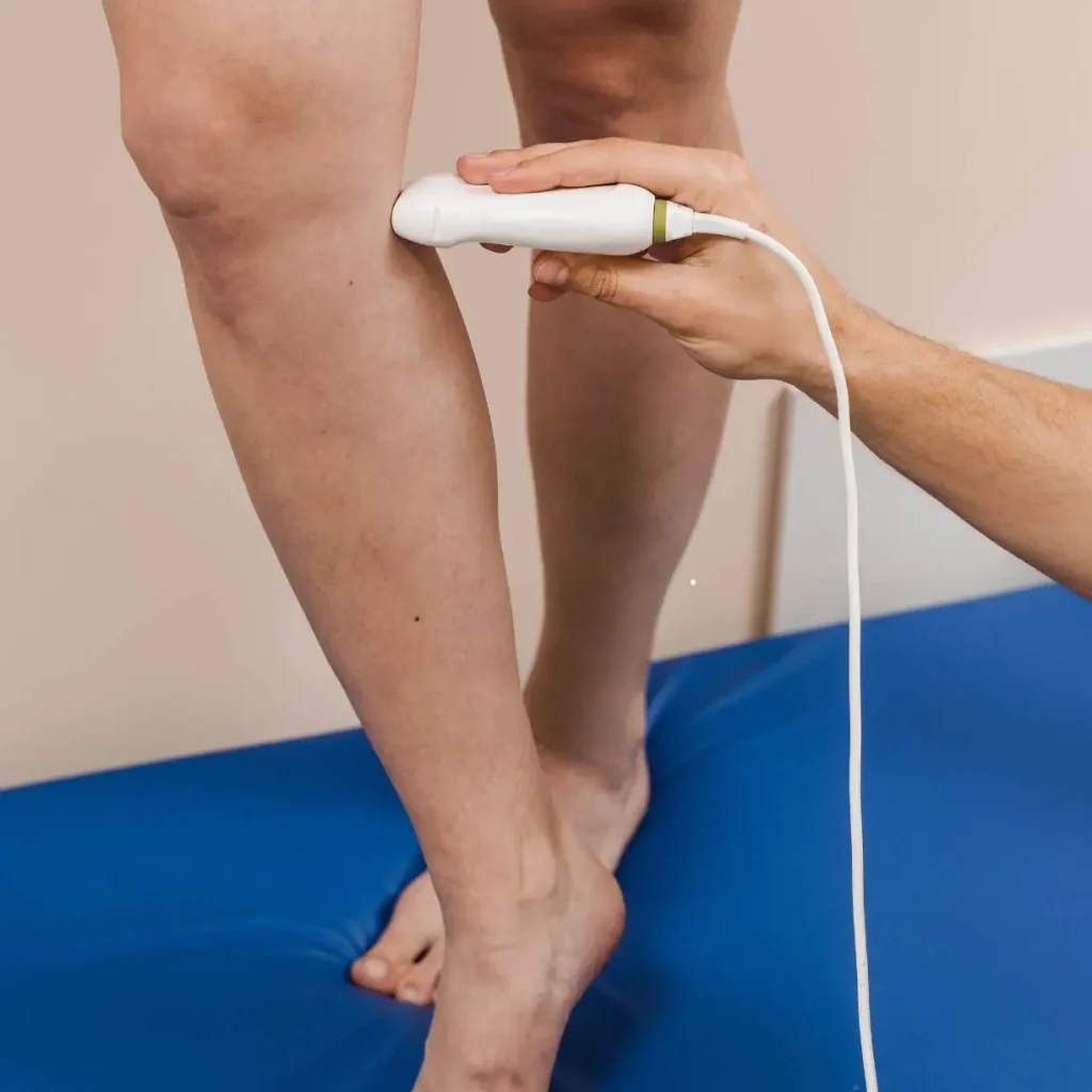 Médico realizando exame de ecografia vascular com doppler nas pernas de um paciente para diagnóstico de varizes e circulação.