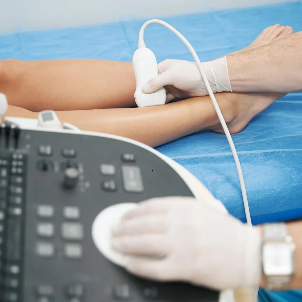 Médico realizando exame de ultrassom doppler vascular na perna de um paciente em consultório em Marília para diagnóstico de varizes.